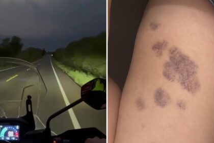 VÍDEO: Motociclistas ficam feridos após serem surpreendidos por granizo em rodovia no RS; grupo passou por supercélula