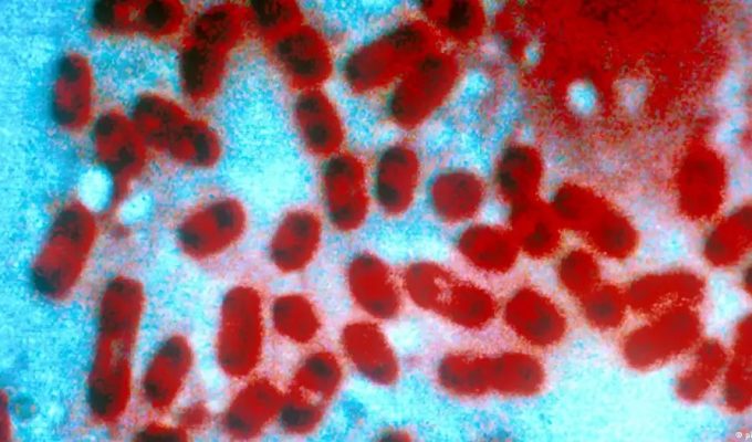 Rússia descarta risco de epidemia após morte de funcionária de laboratório por peste