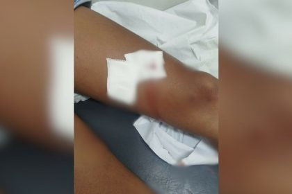 Mulheres são esfaqueadas durante briga motivada por ciúmes e marcada por mensagem em MG