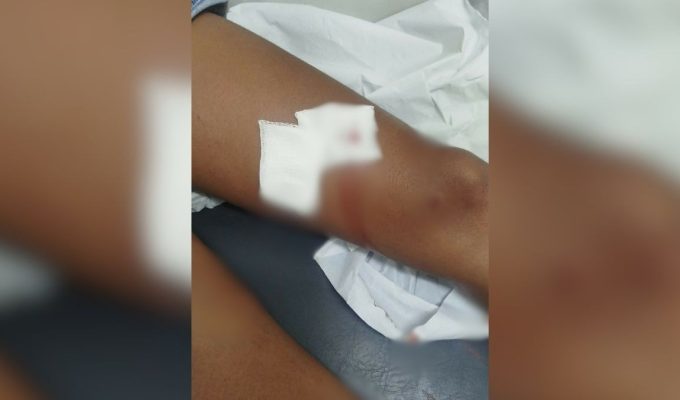 Mulheres são esfaqueadas durante briga motivada por ciúmes e marcada por mensagem em MG