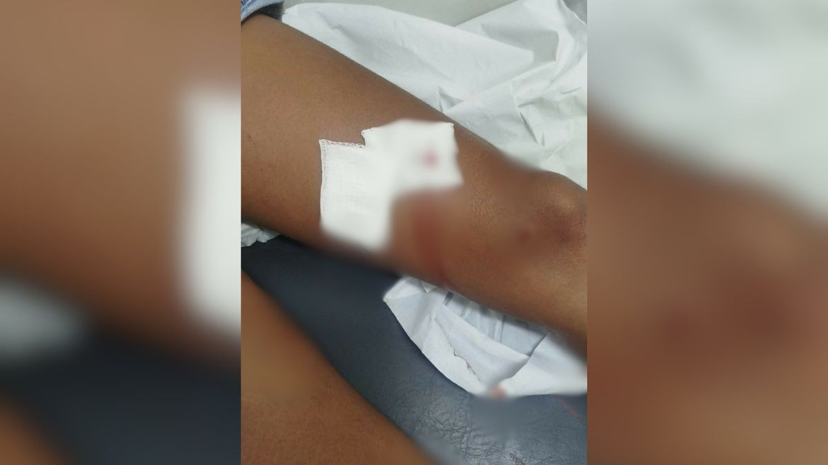 Mulheres são esfaqueadas durante briga motivada por ciúmes e marcada por mensagem em MG