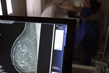 Médicos lançam guia para evitar recusa de mamografia digital