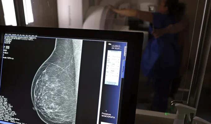 Médicos lançam guia para evitar recusa de mamografia digital
