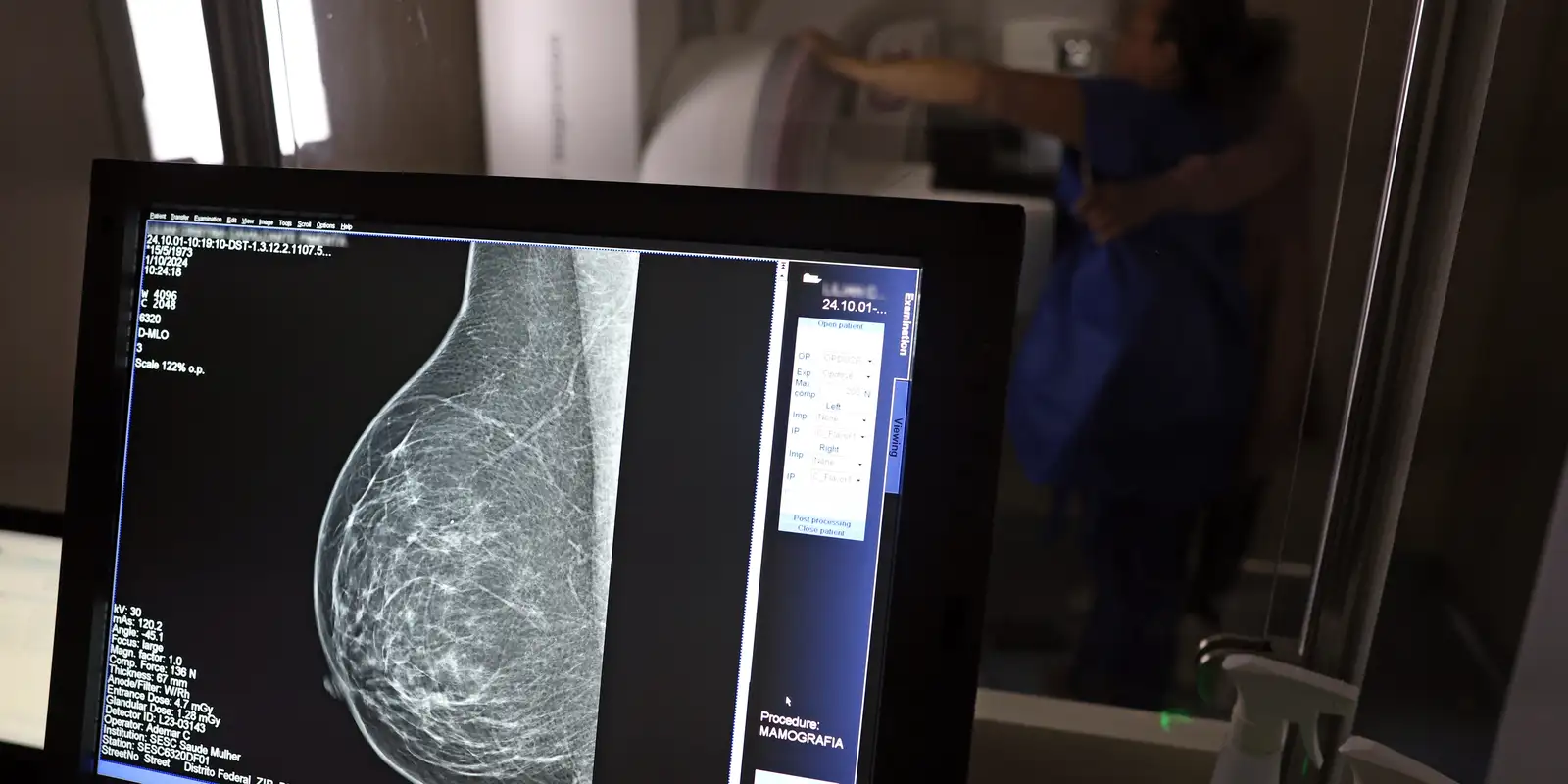 Médicos lançam guia para evitar recusa de mamografia digital