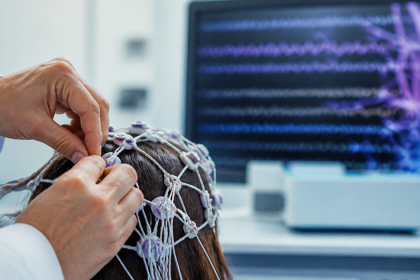 INTELIGÊNCIA ARTIFICIAL PERMITE QUE PACIENTES COM EPILEPSIA ACOMPANHEM SINAIS CEREBRAIS EM TEMPO REAL